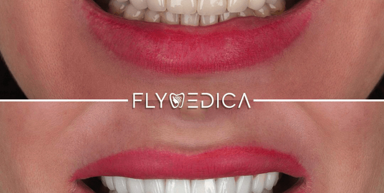 Jak osiągnąć idealny uśmiech? Pielęgnacja, zabiegi, dieta