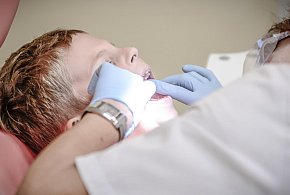NFZ zapłaci za dentystę. Polacy rezygnują, choć mają to za darmo-36003