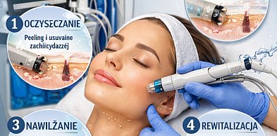 HydraFacial - na czym polega oczyszczanie i nawilżenie skóry premium