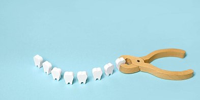 Wyrywanie ósemek – wskazania, przebieg zabiegu i możliwe powikłania