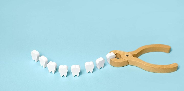 Wyrywanie ósemek – wskazania, przebieg zabiegu