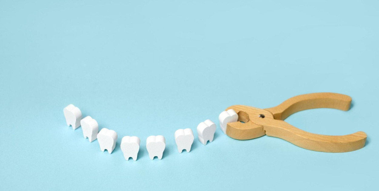 Wyrywanie ósemek – wskazania, przebieg zabiegu i możliwe powikłania